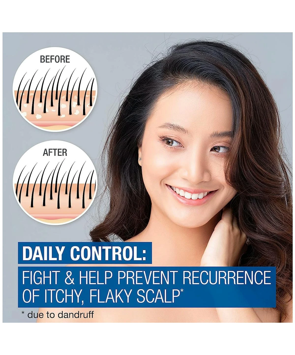 Neutrogena® Scalp Therapy Anti-Dandruff Daily Control 3 Neutrogena® Scalp Therapy Anti-Dandruff Daily Control - Image 2